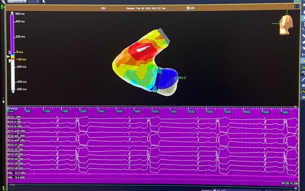 instituto_de_cardiologia_realiza_pela_primeira_vez_procedimento_de_arritmias_complexas__20220209_2051976652.jpeg
